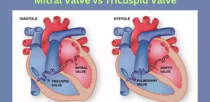 Mitral and Tricuspid Valve