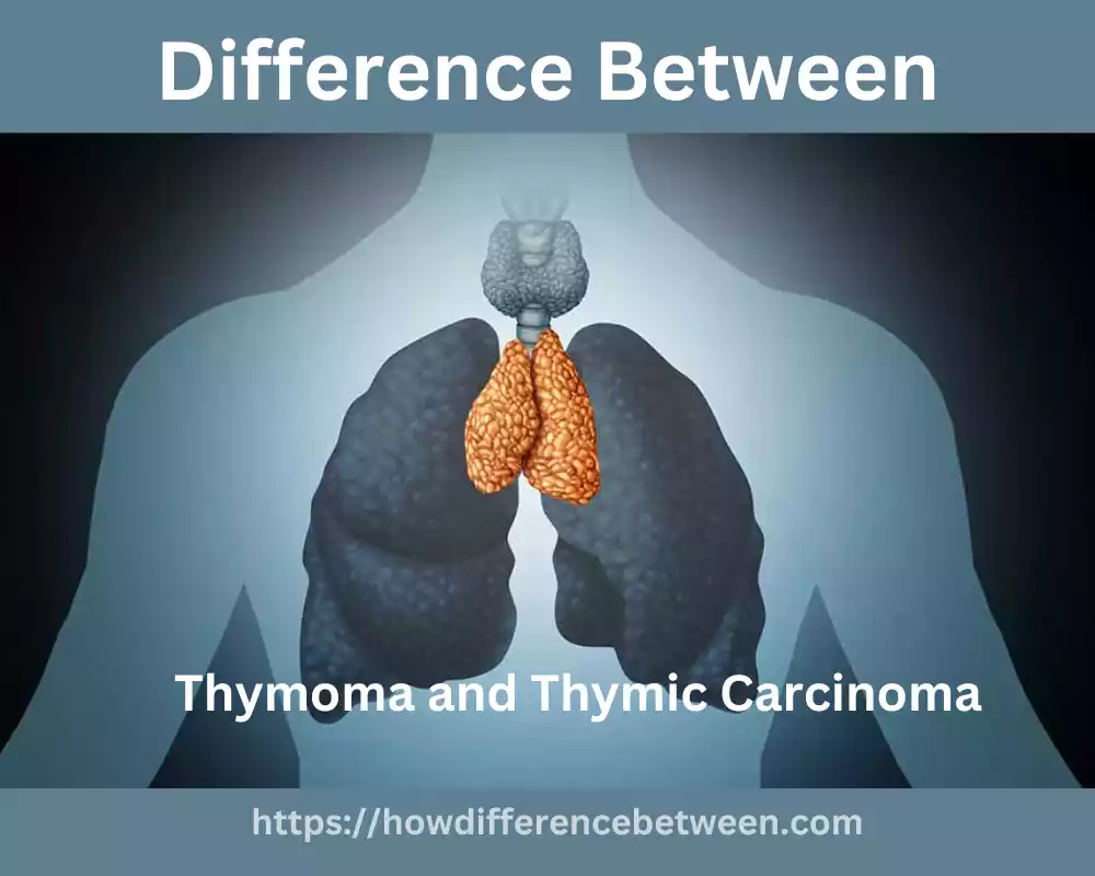 Thymoma and Thymic Carcinoma