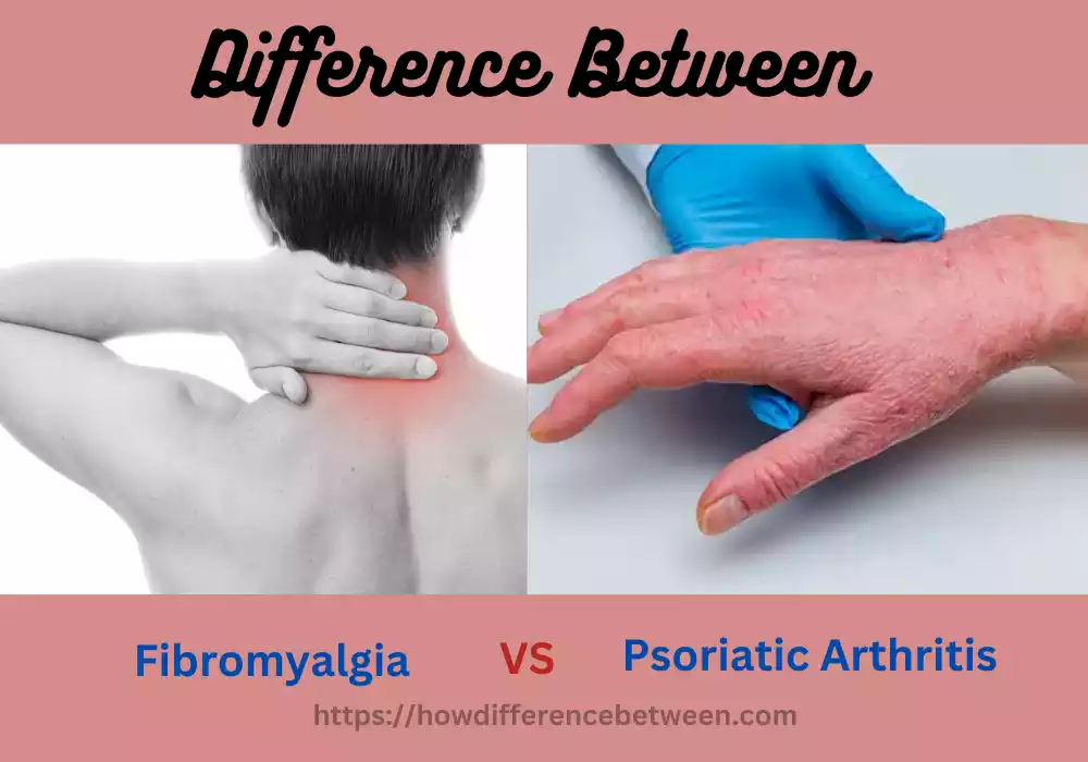 Fibromyalgia and Psoriatic Arthritis