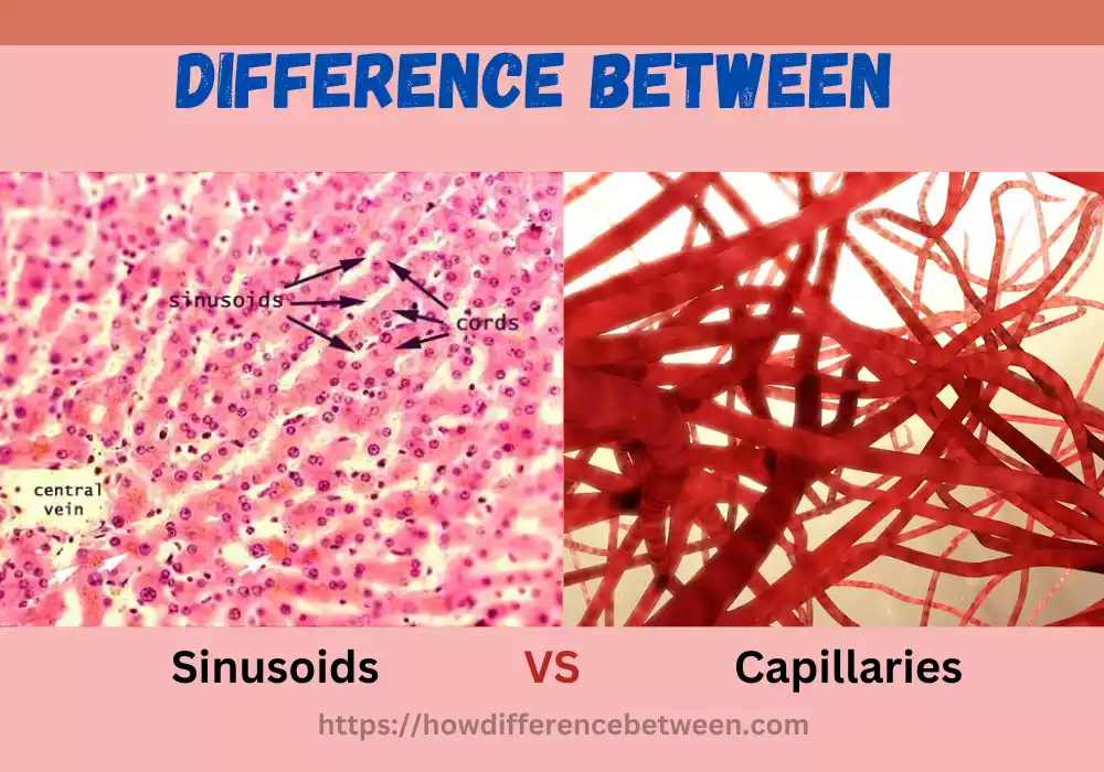Sinusoids and Capillaries