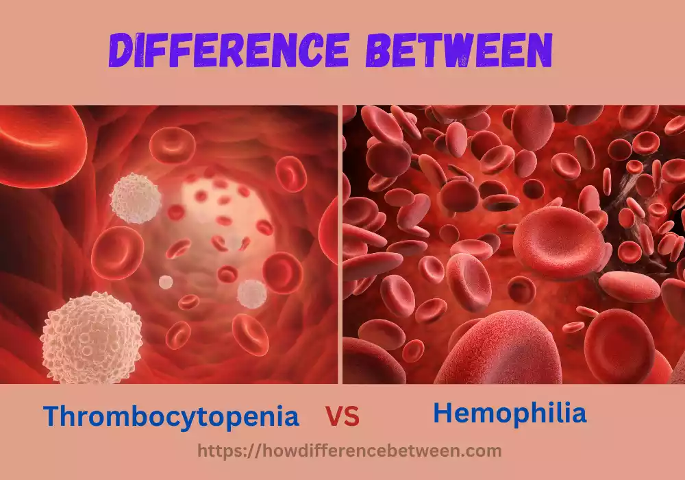 Thrombocytopenia and Hemophilia
