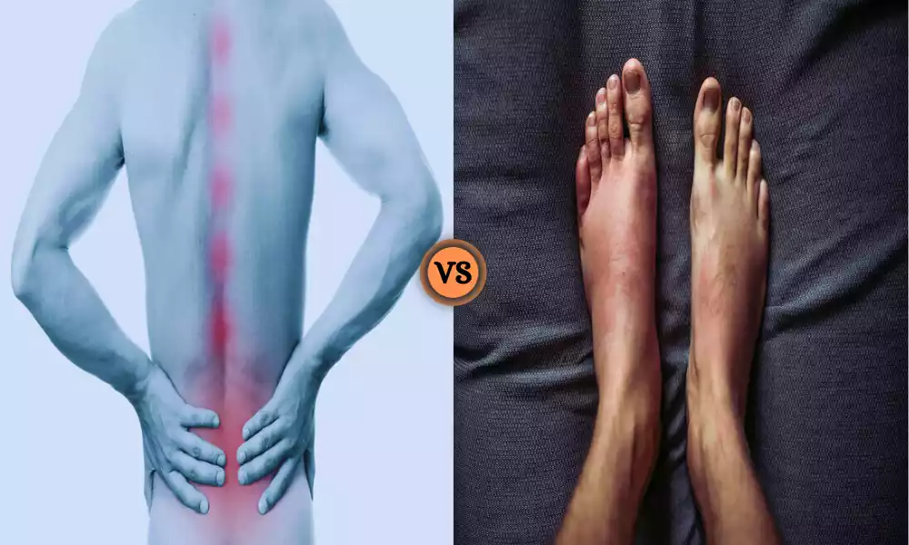 Ankylosing Spondylitis and Psoriatic Arthritis