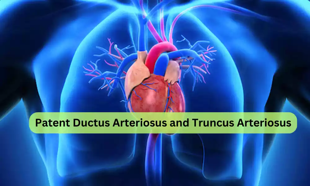 Patent Ductus Arteriosus and Truncus Arteriosus