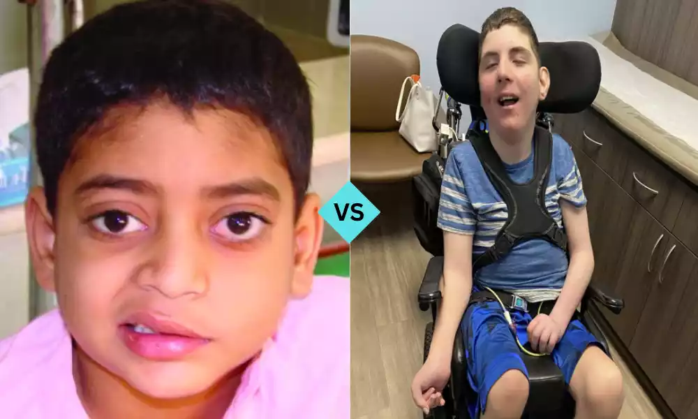 Bell's Palsy and Cerebral Palsy