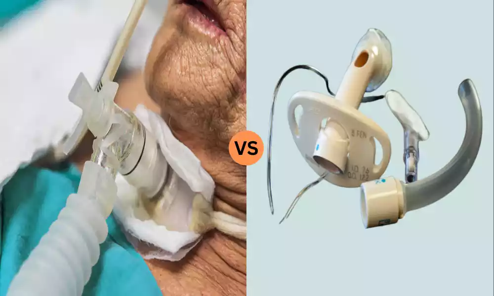 Fenestrated and Non-fenestrated Tracheostomy Tube