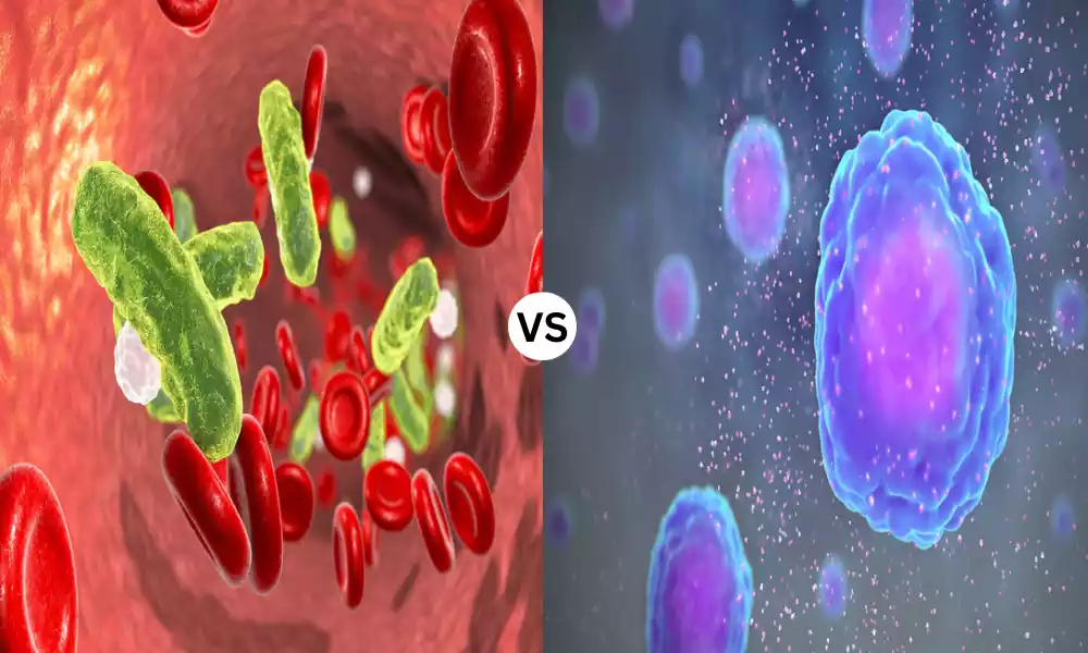 Sepsis and Cytokine Storm