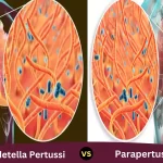 Bordetella Pertussis and Parapertussis - How difference