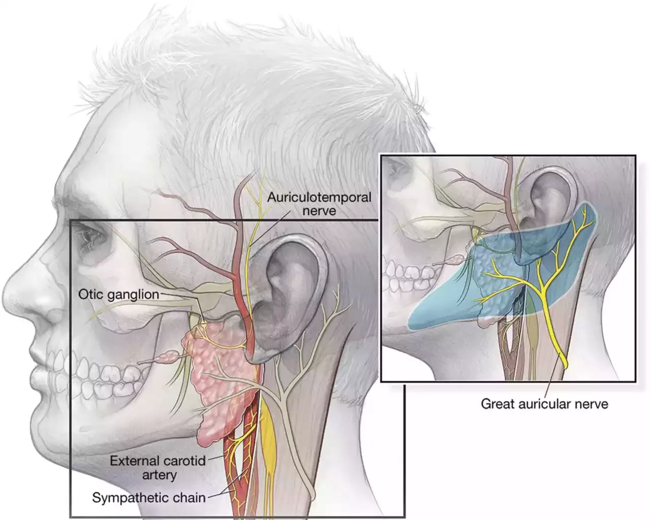 Atypical Trigeminal Neuralgia