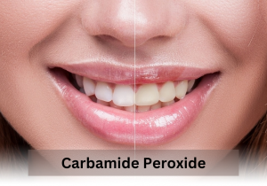 Carbamide Peroxide