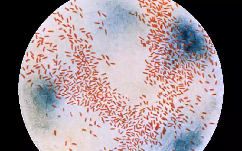 Haemophilus Influenzae