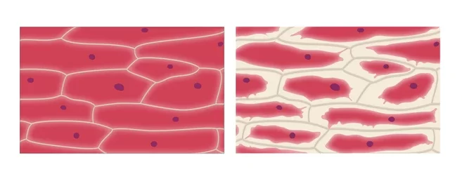 Plasmolysis