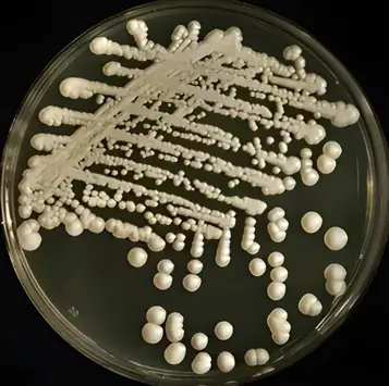 Sabouraud Dextrose Agar