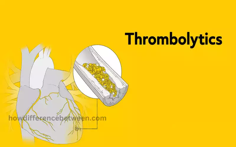 Understanding Thrombolytics